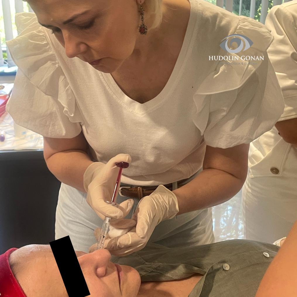 Hijaluronska kiselina